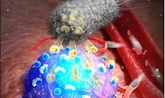 New tech raises precision in tumor imaging during surgery